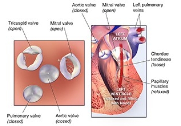 Heart Valve Surgery