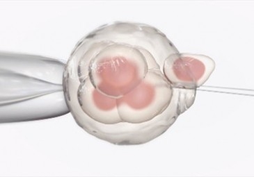 The IVF Procedure