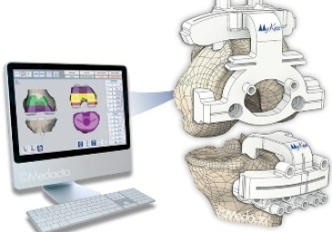 Total Knee Arthroplasty with Patient-Specific Instruments