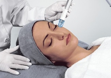 Microdermabrasion