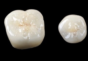 Porcelain Crowns