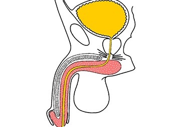 Urethrostomy