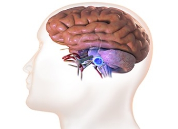 Acoustic Neuroma