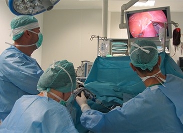 Laparoscopic Colectomy