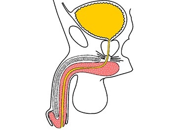 Urethrostomy